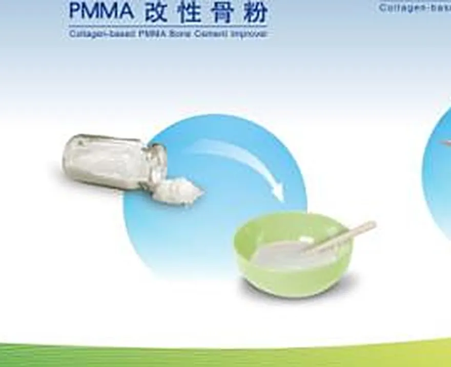 Bột xương nhân tạo BONGOLD Gr-3 trộn cùng xi măng PMMA